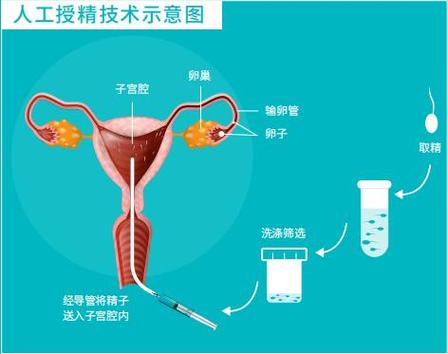 2024试管代怀合法-2024年试管代怀合法:新生命的希望